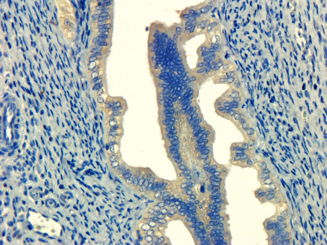 Immunohistochemical analysis of formalin-fixed and paraffin embedded mouse ovary tissue using anti-MHC class I (dilution at 1:100) 