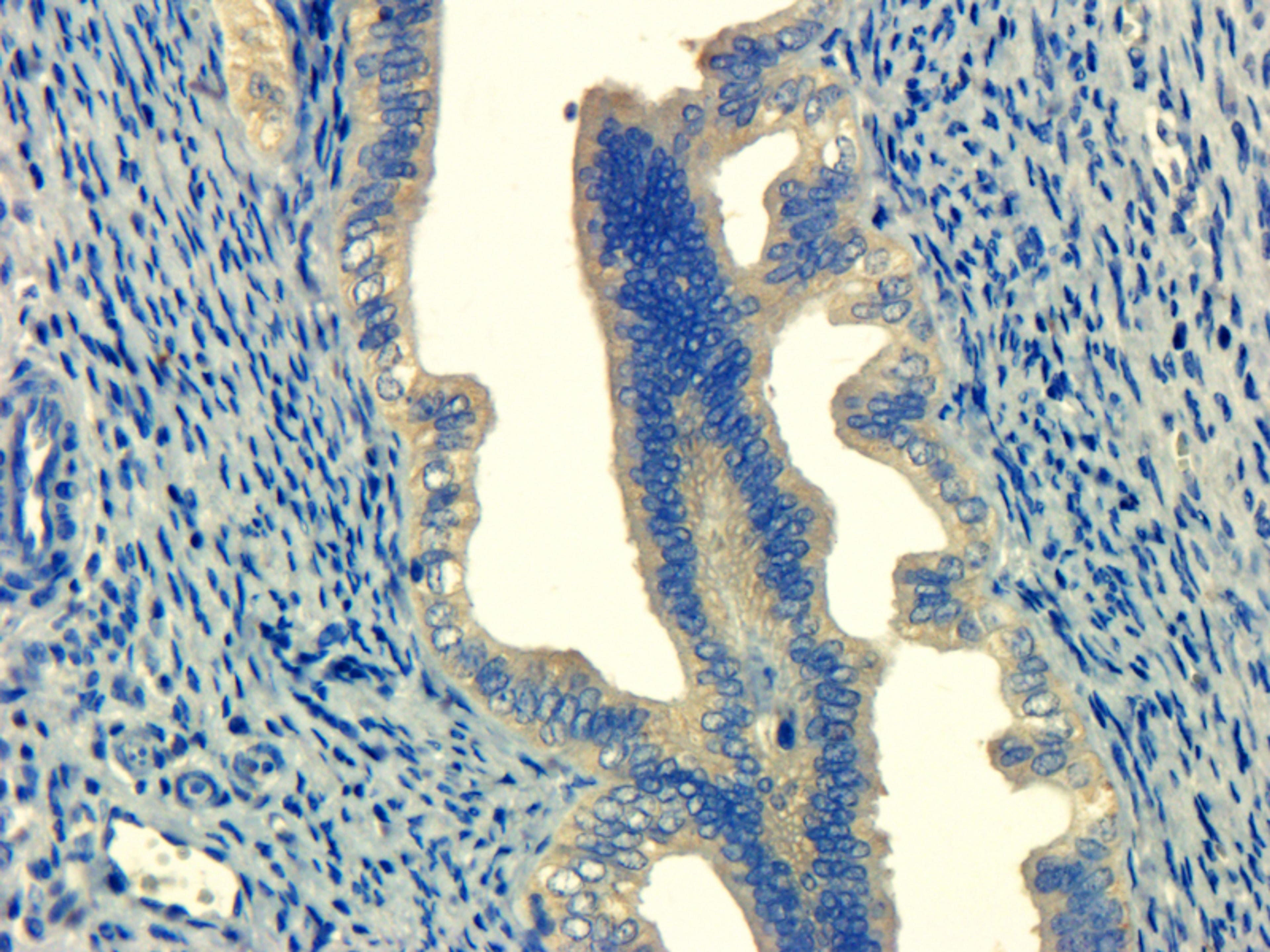 Immunohistochemical analysis of formalin-fixed and paraffin embedded mouse ovary tissue using anti-MHC class I (dilution at 1:100)
