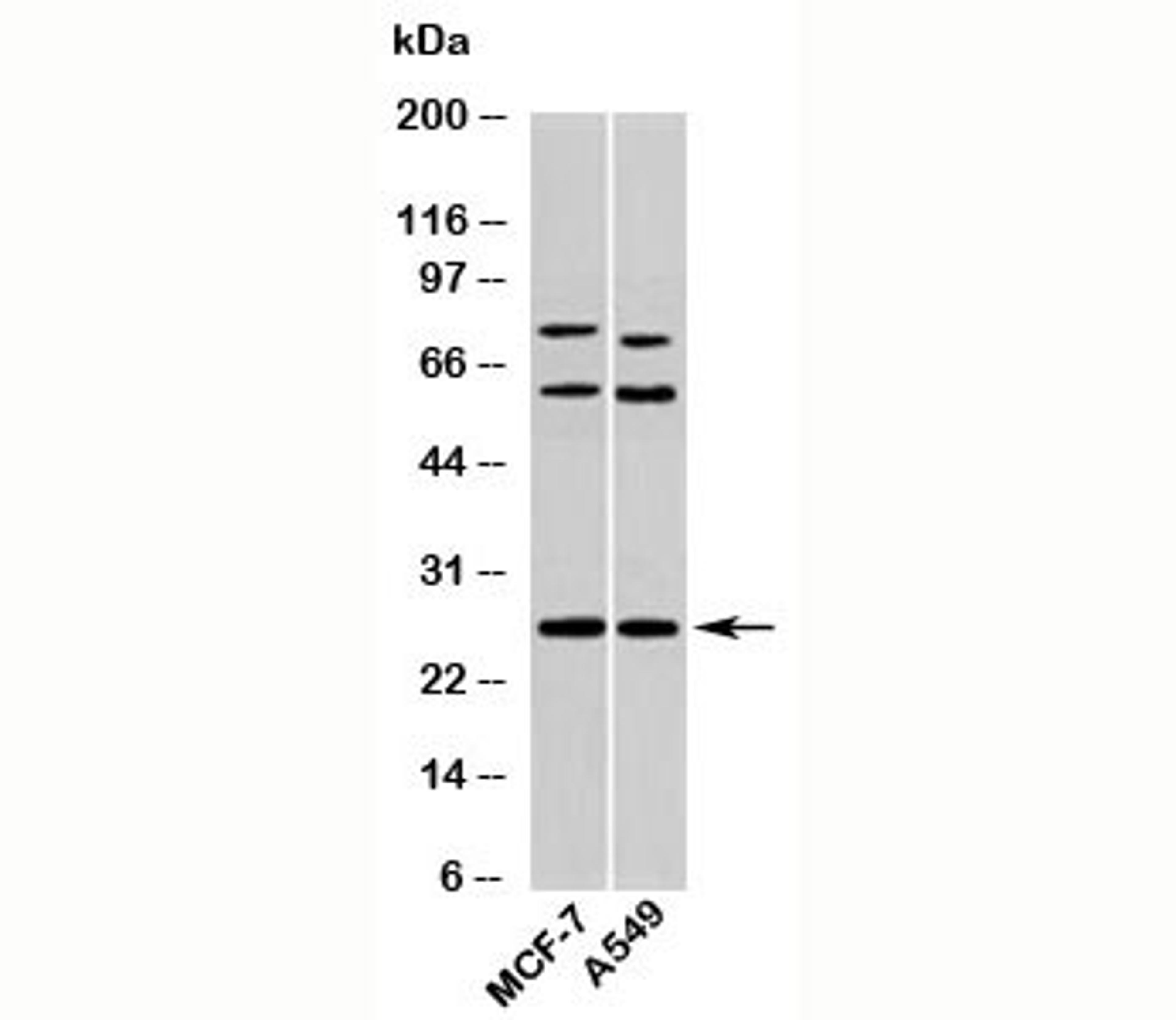 Western blot testing of human samples with Syndecan 4 antibody at 2ug/ml.