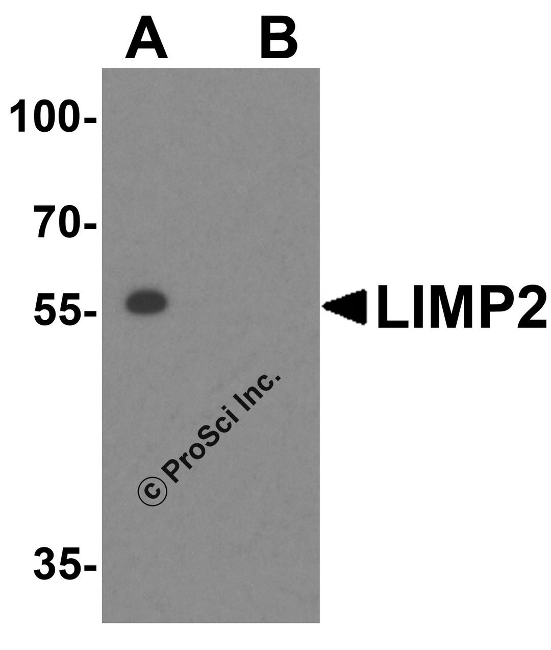 Western blot analysis of LIMP2 in mouse liver tissue lysate with LIMP2 antibody at 1 μg/mL in (A) the absence and (B) presence of blocking peptide.