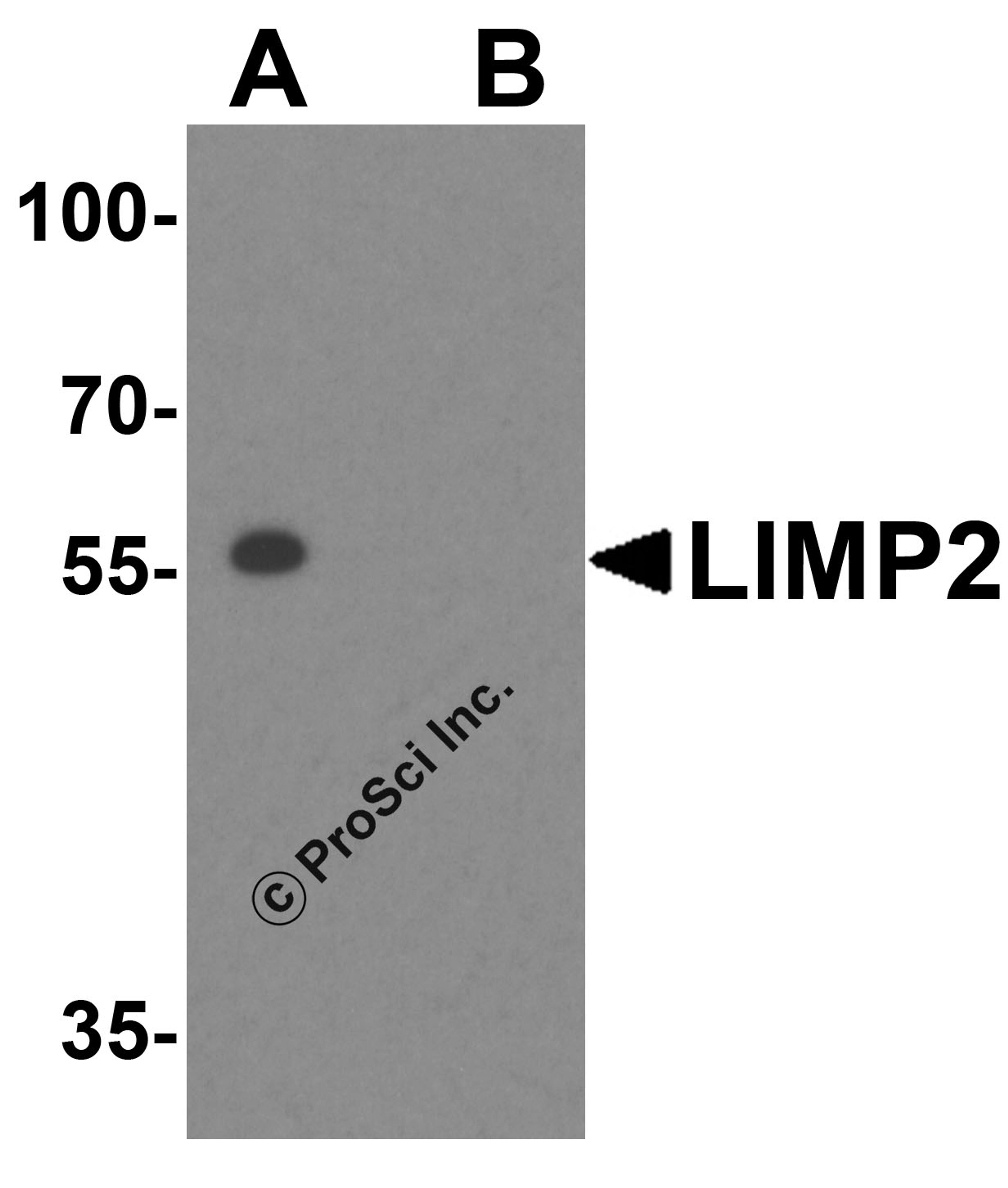 Western blot analysis of LIMP2 in mouse liver tissue lysate with LIMP2 antibody at 1 μg/mL in (A) the absence and (B) presence of blocking peptide.