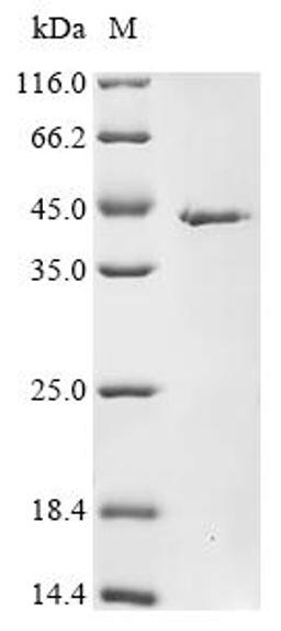 (Tris-Glycine gel) Discontinuous SDS-PAGE (reduced) with 5% enrichment gel and 15% separation gel.