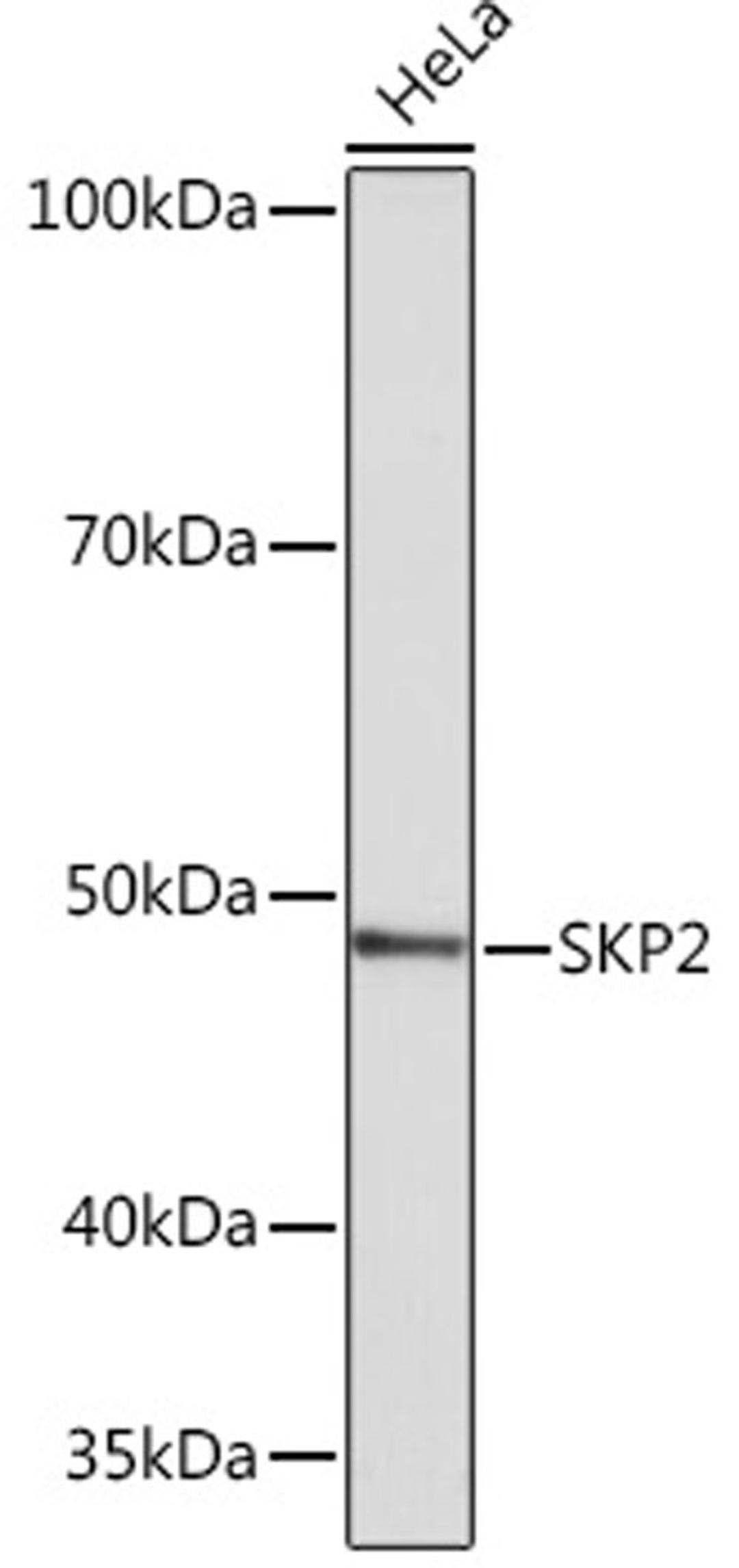 Western blot - SKP2  Rabbit mAb (A4046)