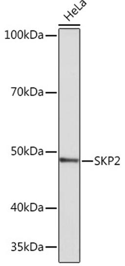 Western blot - SKP2 Rabbit mAb (A4046)