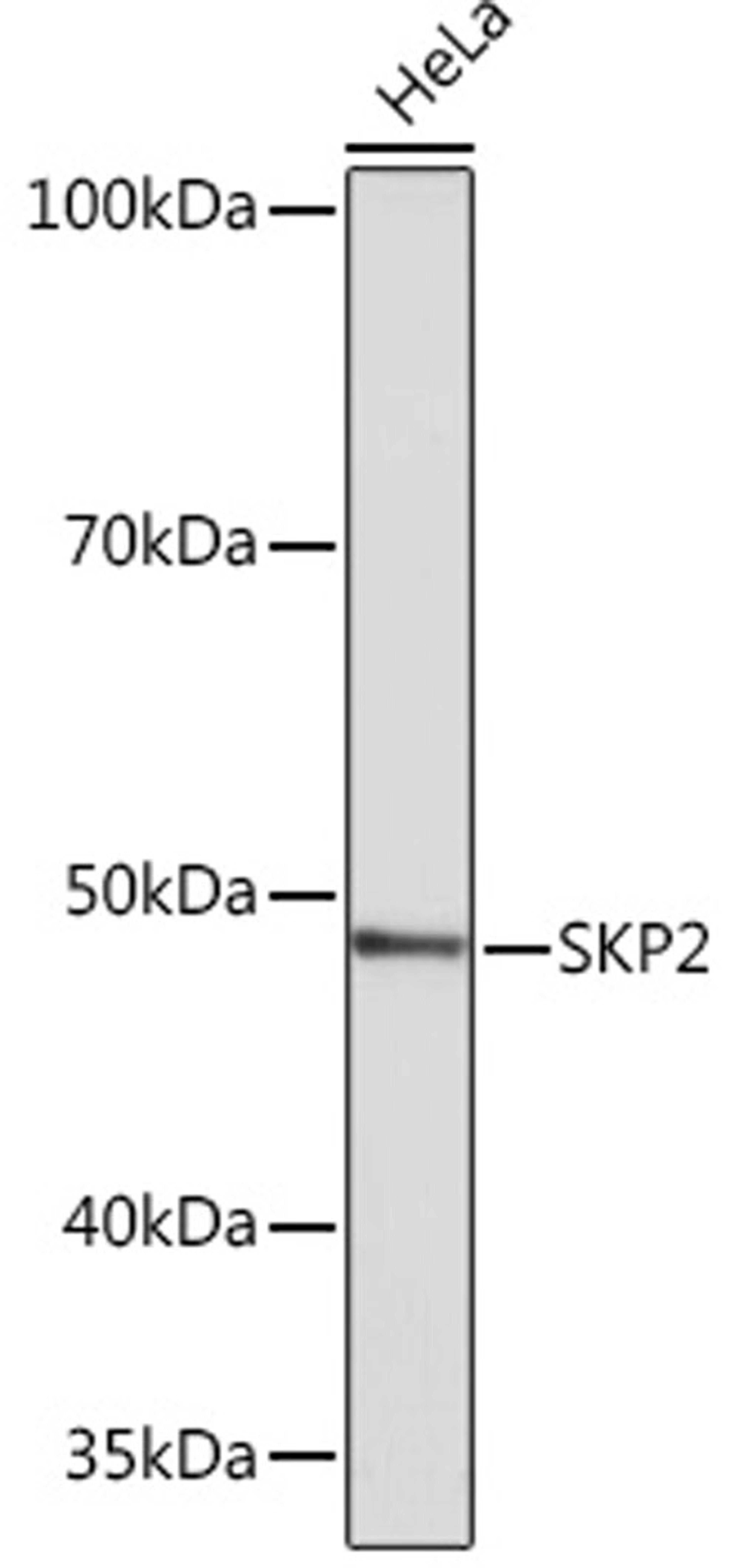 Western blot - SKP2 Rabbit mAb (A4046)