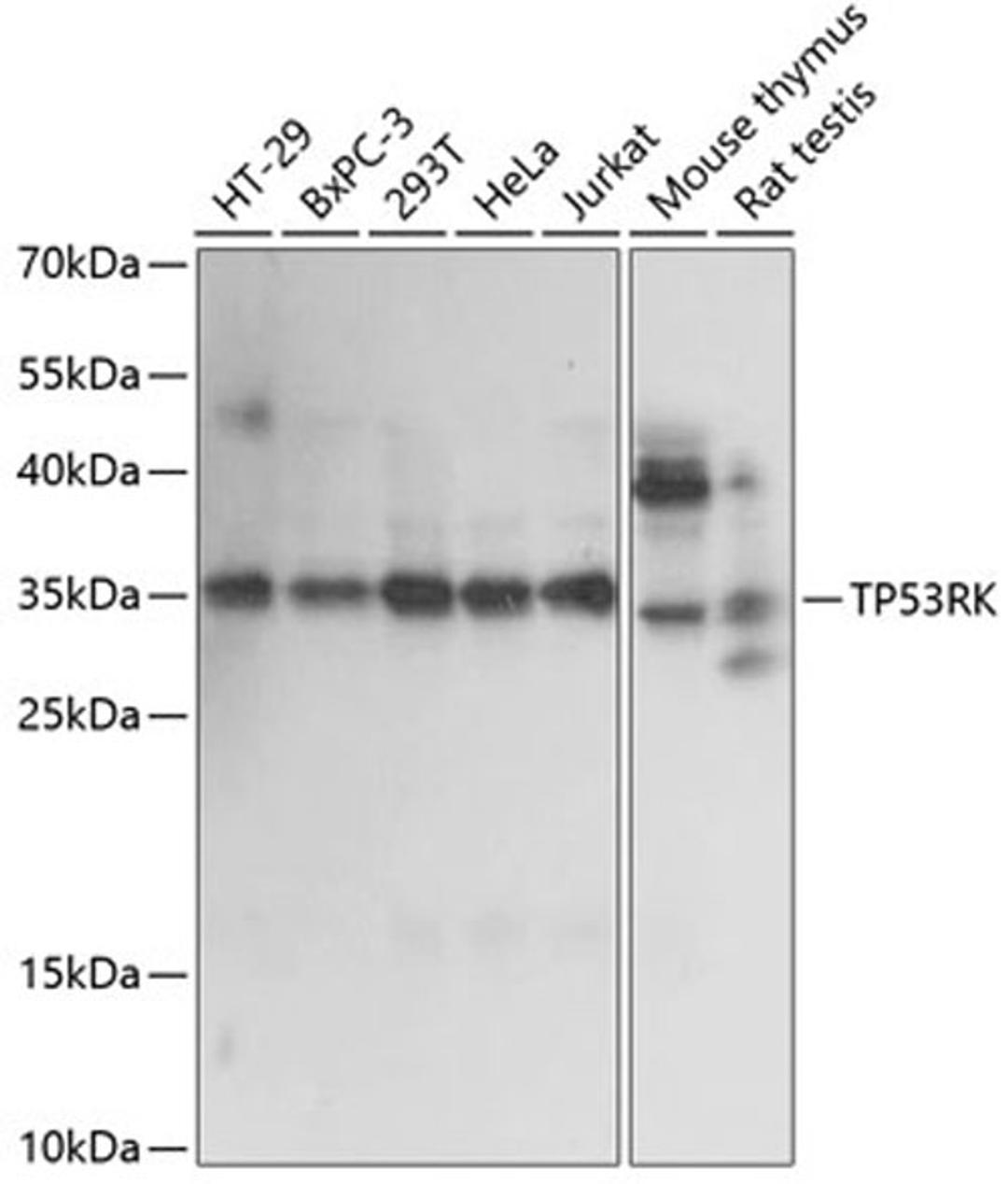 Western blot - TP53RK antibody (A14952)