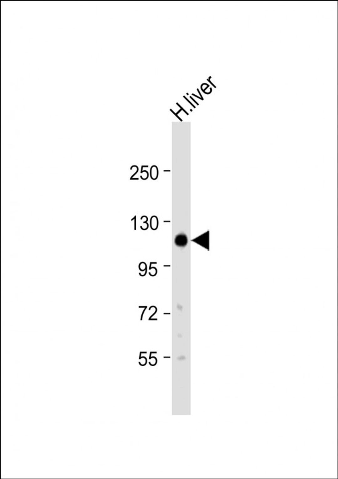 Western Blot at 1:500 dilution + human liver lysate Lysates/proteins at 20 ug per lane.