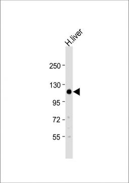 Western Blot at 1:500 dilution + human liver lysate Lysates/proteins at 20 ug per lane.