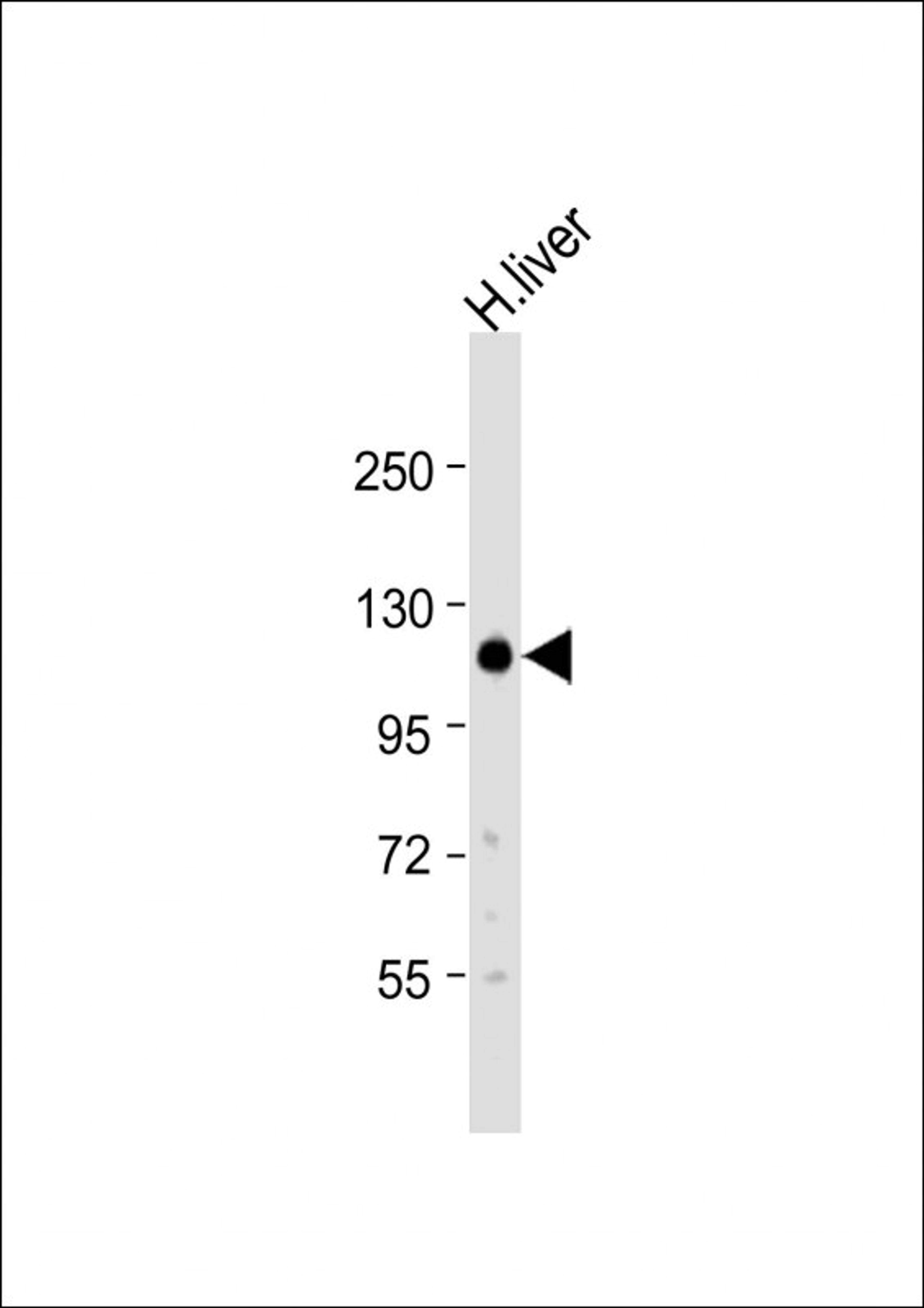 Western Blot at 1:500 dilution + human liver lysate Lysates/proteins at 20 ug per lane.