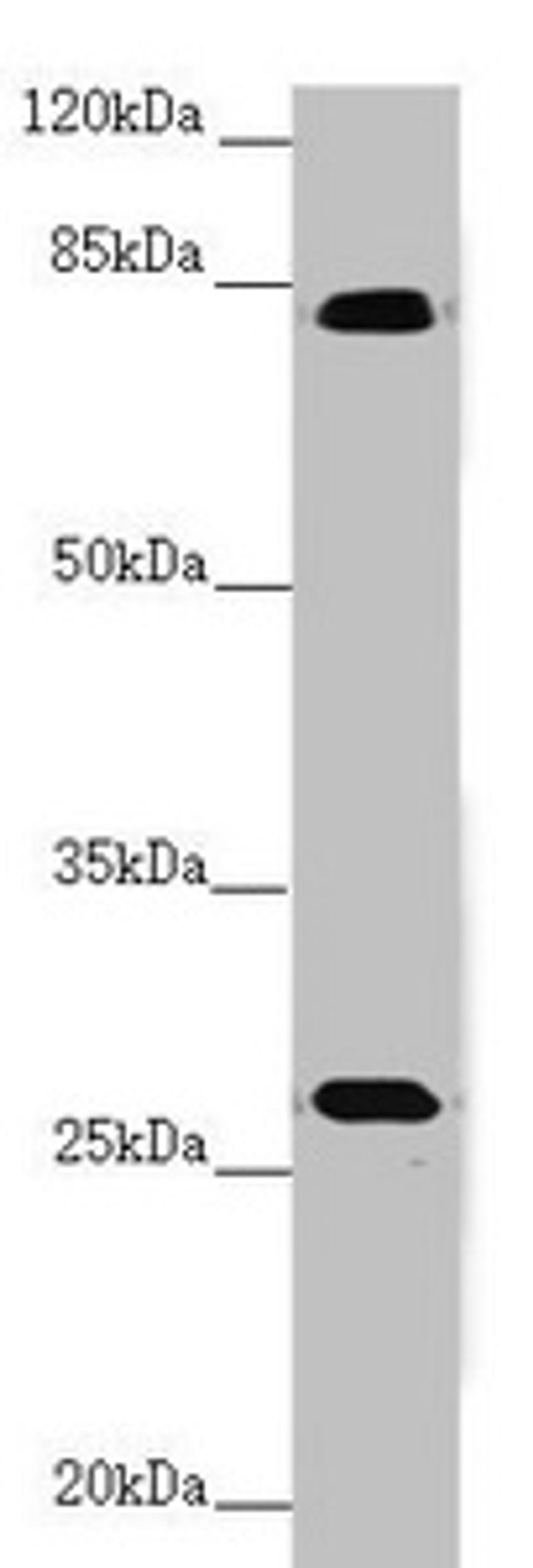 Western blot. All lanes: MID2 antibody at 3.32 ug/ml + Mouse small intestine tissue. Secondary. Goat polyclonal to rabbit IgG at 1/10000 dilution. Predicted band size: 84, 80 kDa. Observed band size: 84, 30 kDa. 
