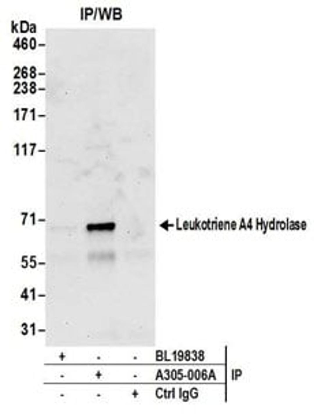 Detection of human Leukotriene A4 Hydrolase by western blot of immunoprecipitates.