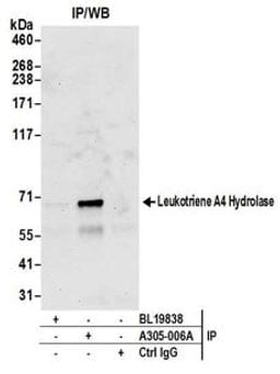 Detection of human Leukotriene A4 Hydrolase by western blot of immunoprecipitates.