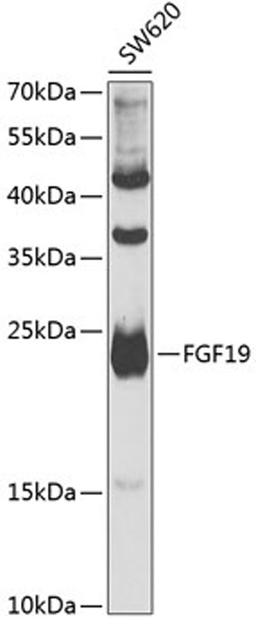 Western blot - FGF19 antibody (A6589)