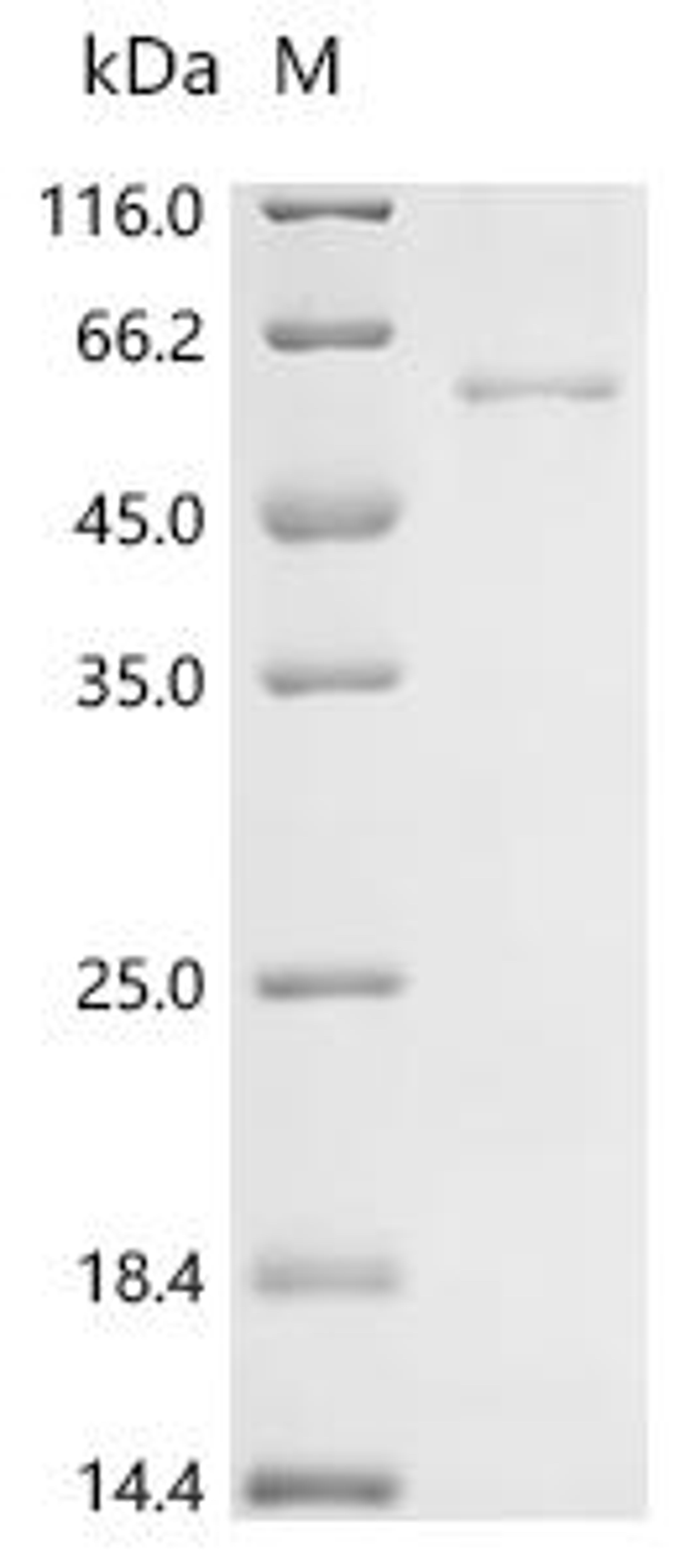 (Tris-Glycine gel) Discontinuous SDS-PAGE (reduced) with 5% enrichment gel and 15% separation gel.