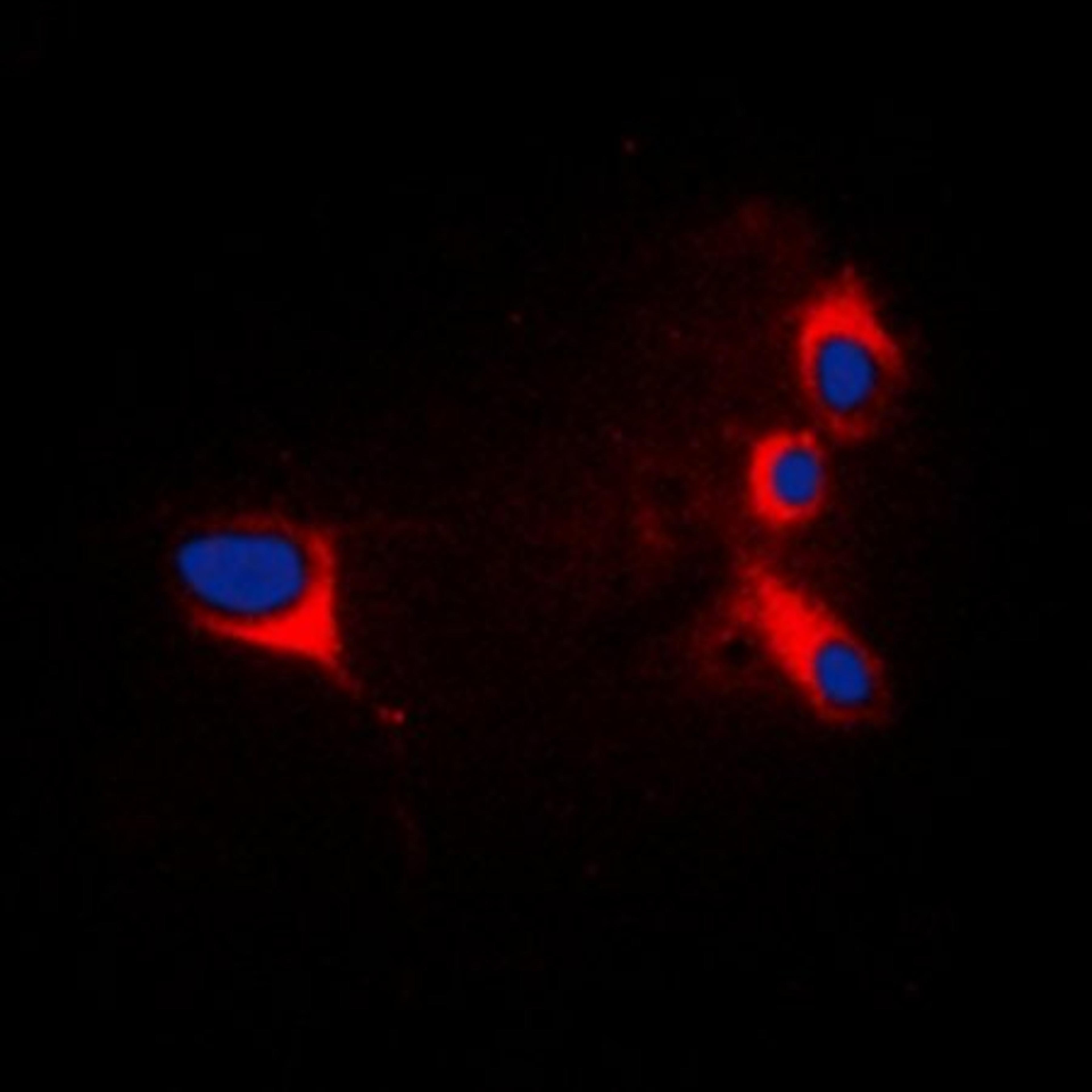 Immunofluorescense analysis of HepG2 cells using cTnI antibody