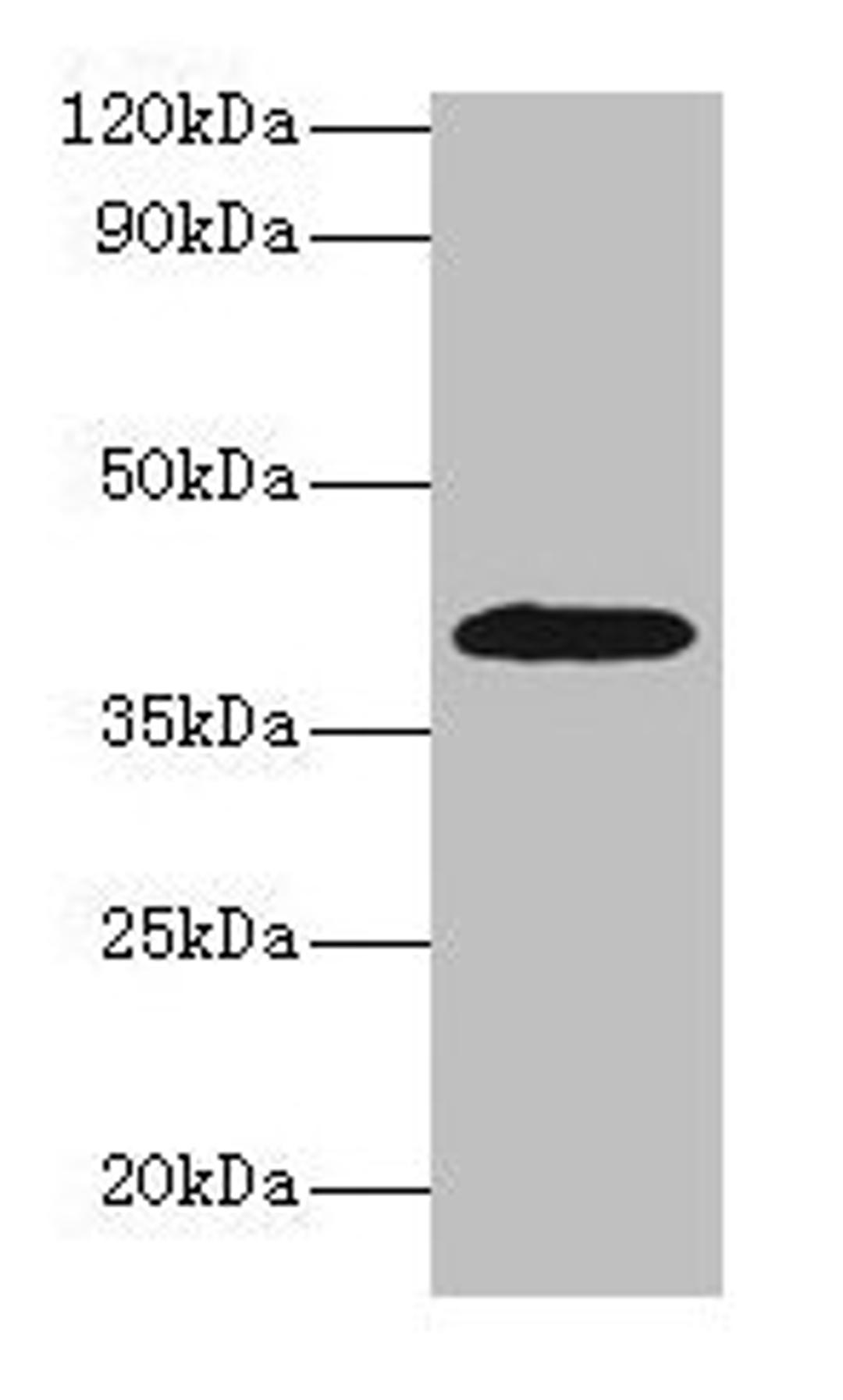 Western blot. All lanes: ADH1B antibody at 2µg/ml + HepG2 whole cell lysate. Secondary. Goat polyclonal to rabbit IgG at 1/15000 dilution. Predicted band size: 40, 36 kDa. Observed band size: 40 kDa