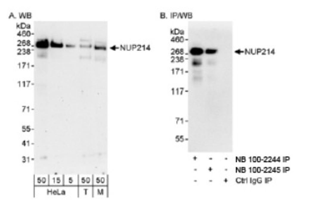 Western Blot: NUP214 Antibody [NB100-2245] - Detection of Human and Mouse NUP214 on HeLa whole cell lysate using NB100-2245. NUP214 was also immunoprecipitated using rabbit anti-NUP214  antibody NB100-2244.