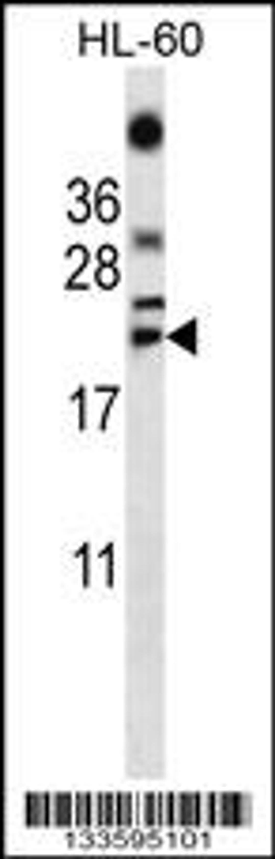 Western blot analysis in HL-60 cell line lysates (35ug/lane).