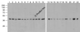 Western blot analysis of Actin in 293, A431, A549, Daudi, HeLa, HepG2, Jurkat, K562, MOLT4, 3T3, Raji, THP-1, mouse brain, rat brain, rabbit brain, mouse lung, rat lung, mouse liver, rat liver, rabbit spleen, chicken small intestine, and drosophila lysate