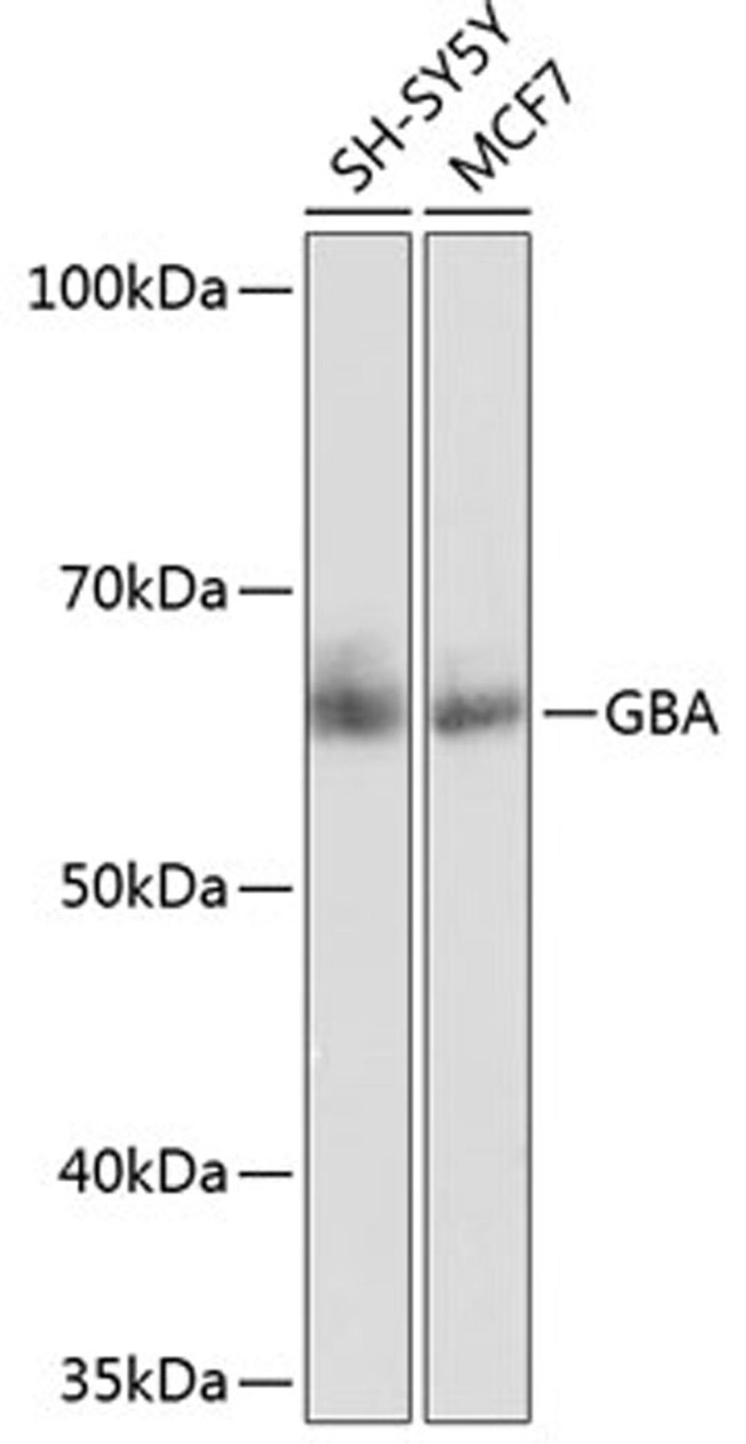 Western blot - GBA antibody (A19057)