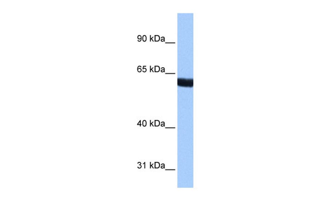 Antibody used in WB on Human Brain at 0.2-1 ug/ml.