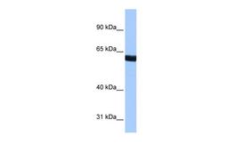 Antibody used in WB on Human Brain at 0.2-1 ug/ml.