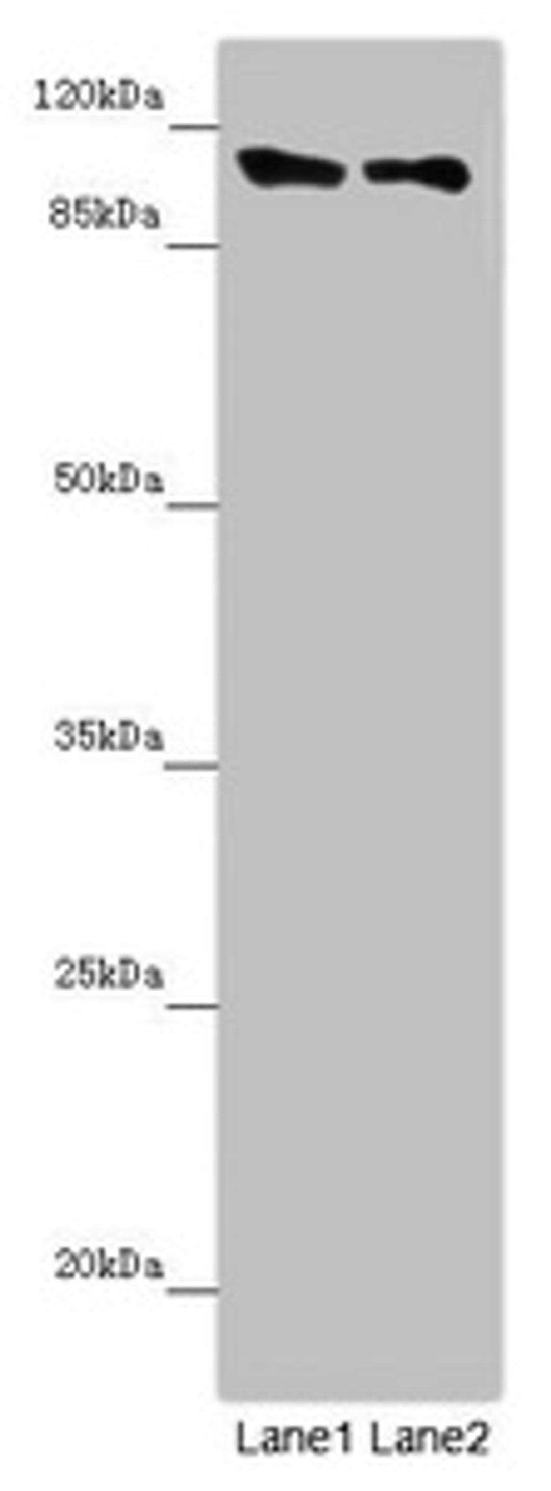 Western blot. All lanes: DDX11 antibody at 8.47µg/ml. Lane 1: Mouse gonadal tissue. Lane 2: K562 whole cell lysate. Secondary. Goat polyclonal to rabbit IgG at 1/10000 dilution. Predicted band size: 109, 102, 99, 97, 33 kDa. Observed band size: 109 kDa