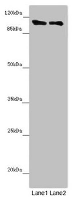 Western blot. All lanes: DDX11 antibody at 8.47µg/ml. Lane 1: Mouse gonadal tissue. Lane 2: K562 whole cell lysate. Secondary. Goat polyclonal to rabbit IgG at 1/10000 dilution. Predicted band size: 109, 102, 99, 97, 33 kDa. Observed band size: 109 kDa