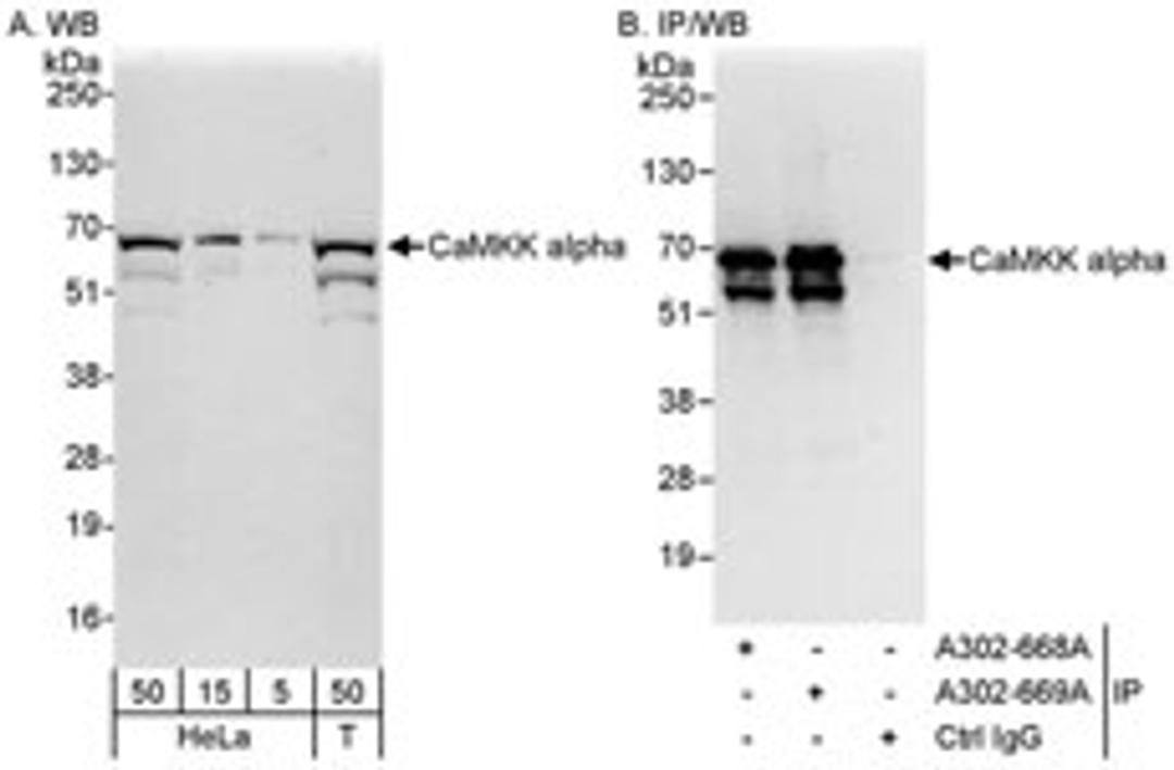 Detection of human CaMKK alpha by western blot and immunoprecipitation.