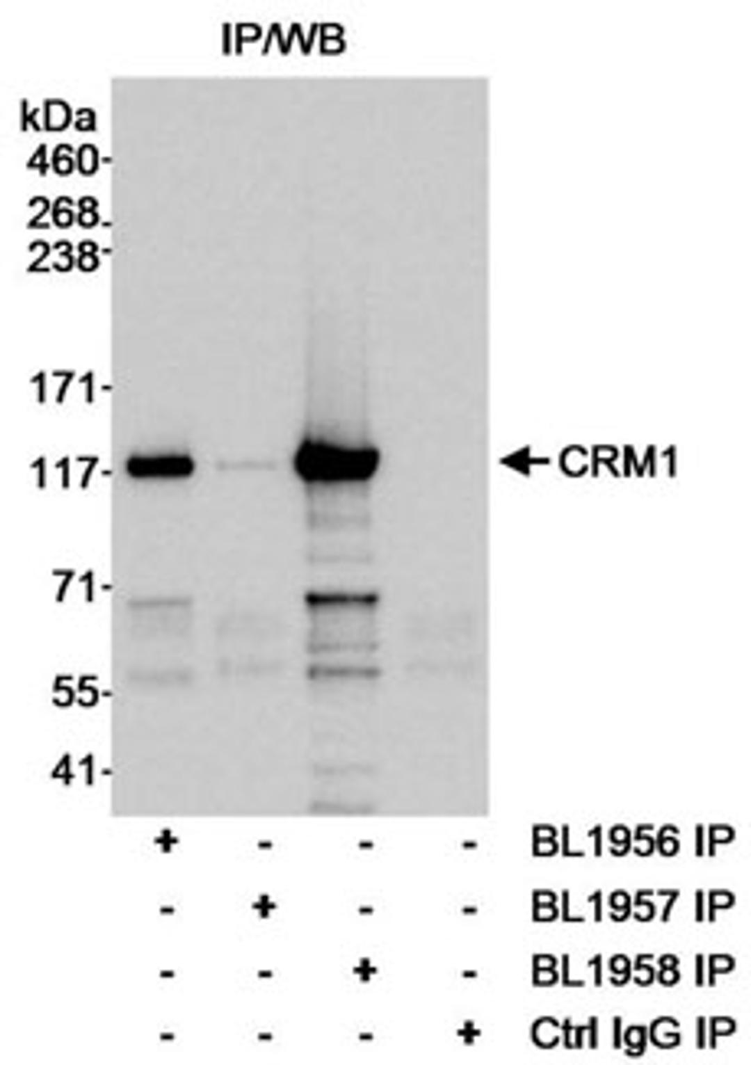 Detection of CRM1 (Exportin 1) by immunoprecipitation.