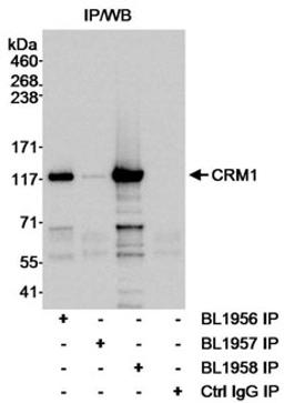 Detection of CRM1 (Exportin 1) by immunoprecipitation.