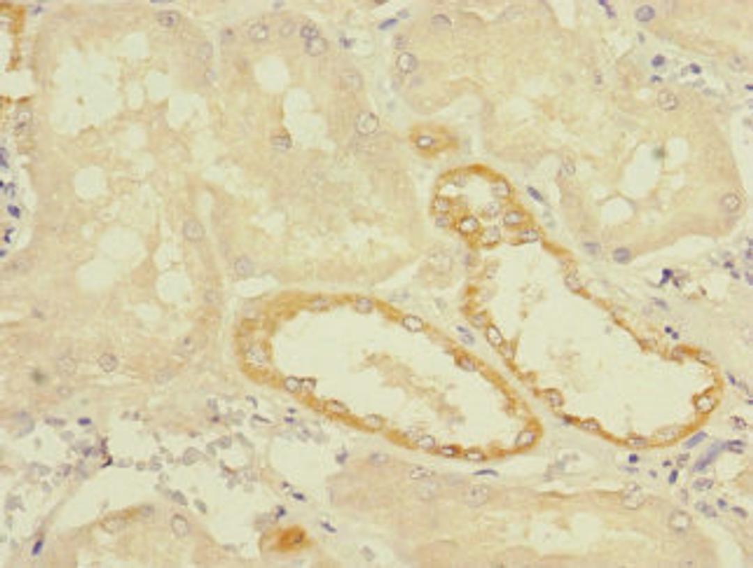 Immunohistochemistry of paraffin-embedded human kidney tissue using CSB-PA023709LA01HU at dilution of 1:100