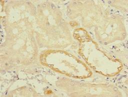 Immunohistochemistry of paraffin-embedded human kidney tissue using CSB-PA023709LA01HU at dilution of 1:100
