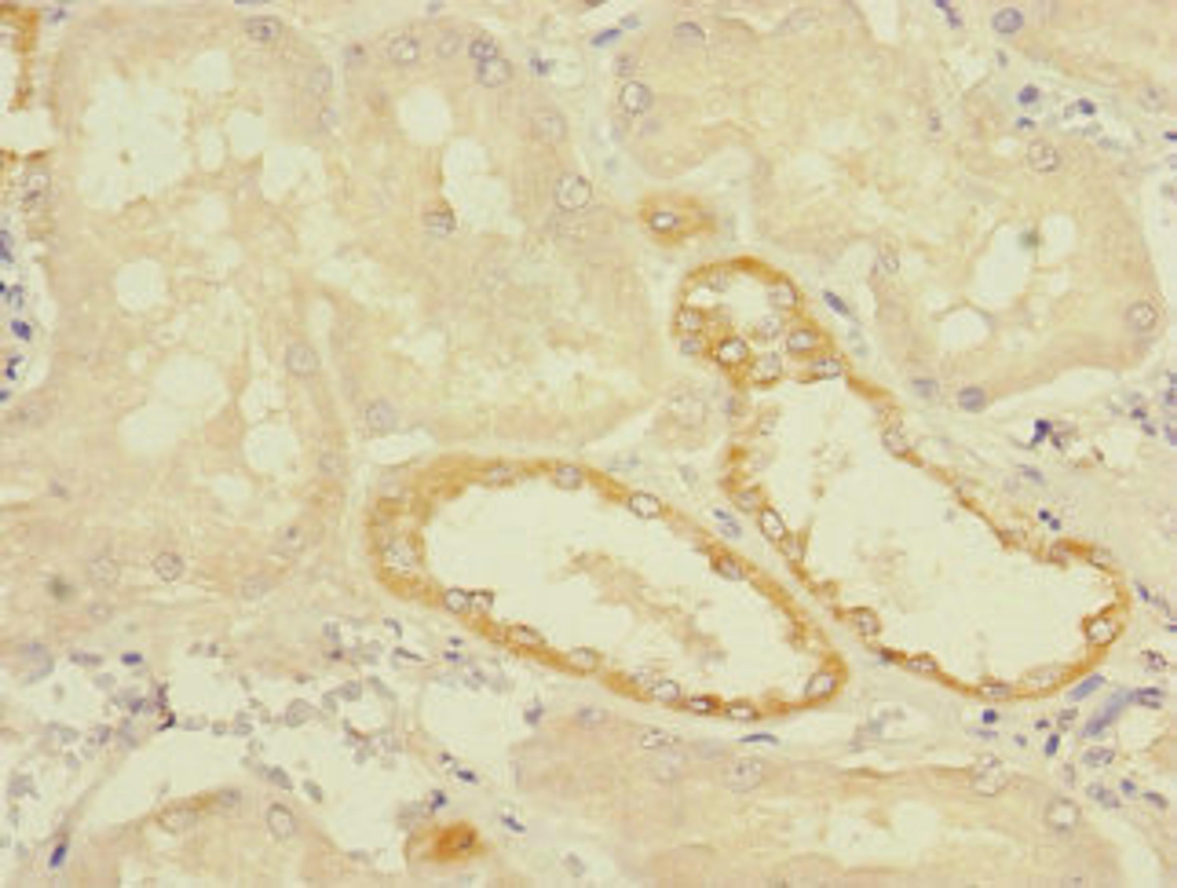Immunohistochemistry of paraffin-embedded human kidney tissue using CSB-PA023709LA01HU at dilution of 1:100