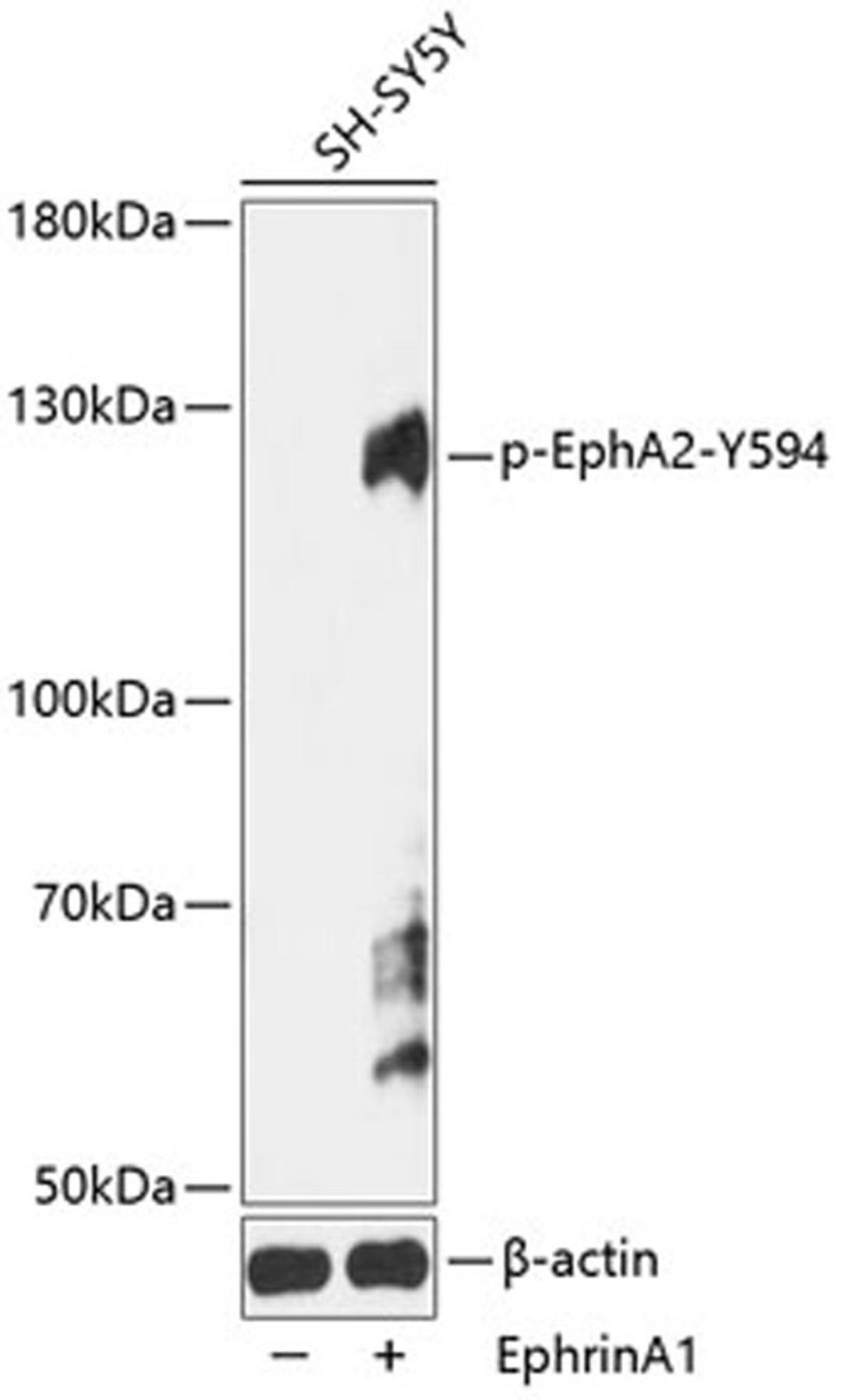 Western blot - Phospho-EphA2-Y594 antibody (AP0818)