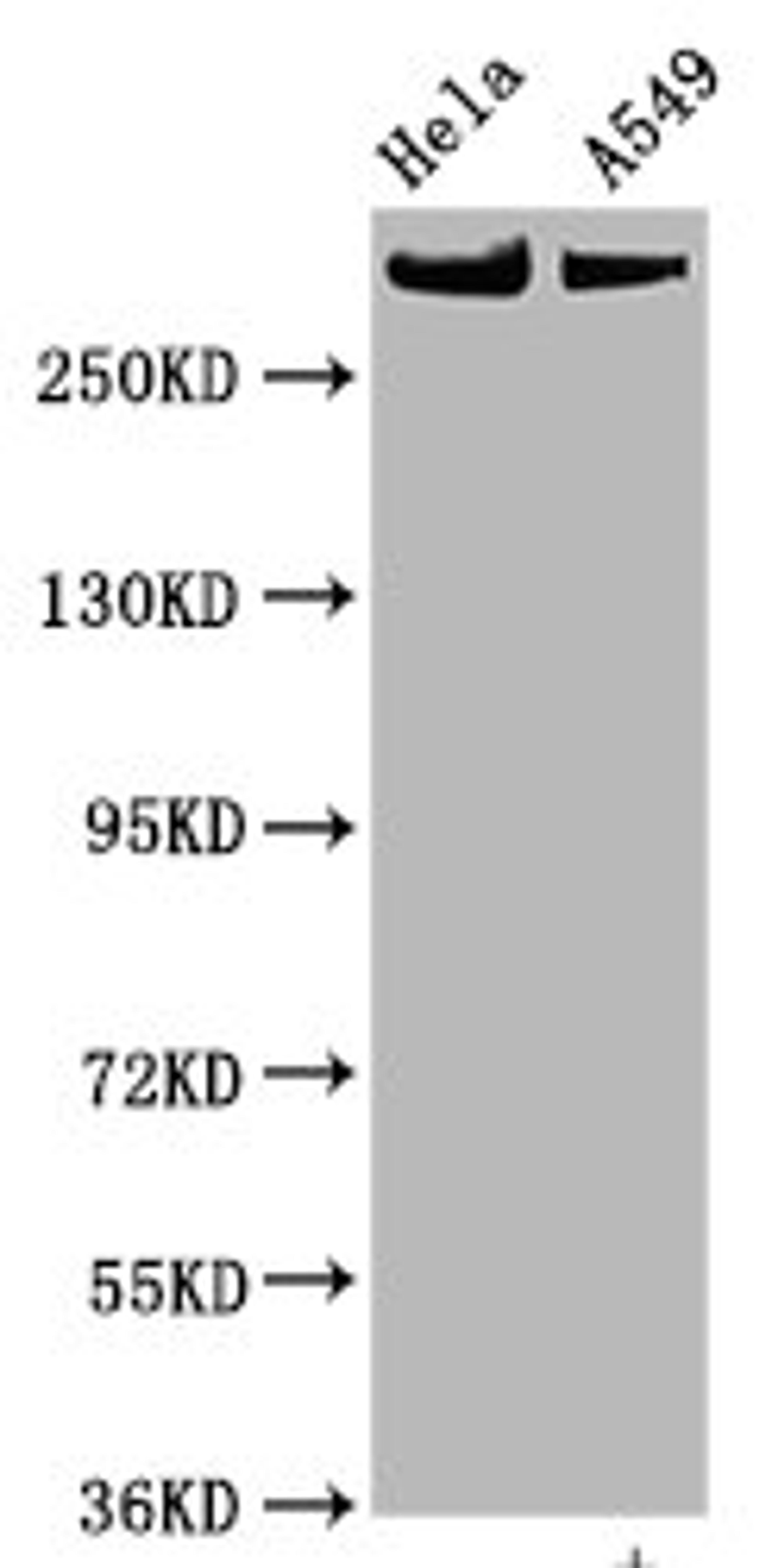 Western Blot. Positive WB detected in Hela whole cell lysate,A549 whole cell lysate. All lanes Phospho-MTOR antibody at 0.825μg/ml. Secondary. Goat polyclonal to rabbit IgG at 1/50000 dilution. Predicted band size: 289 KDa. Observed band size: 289 KDa. 