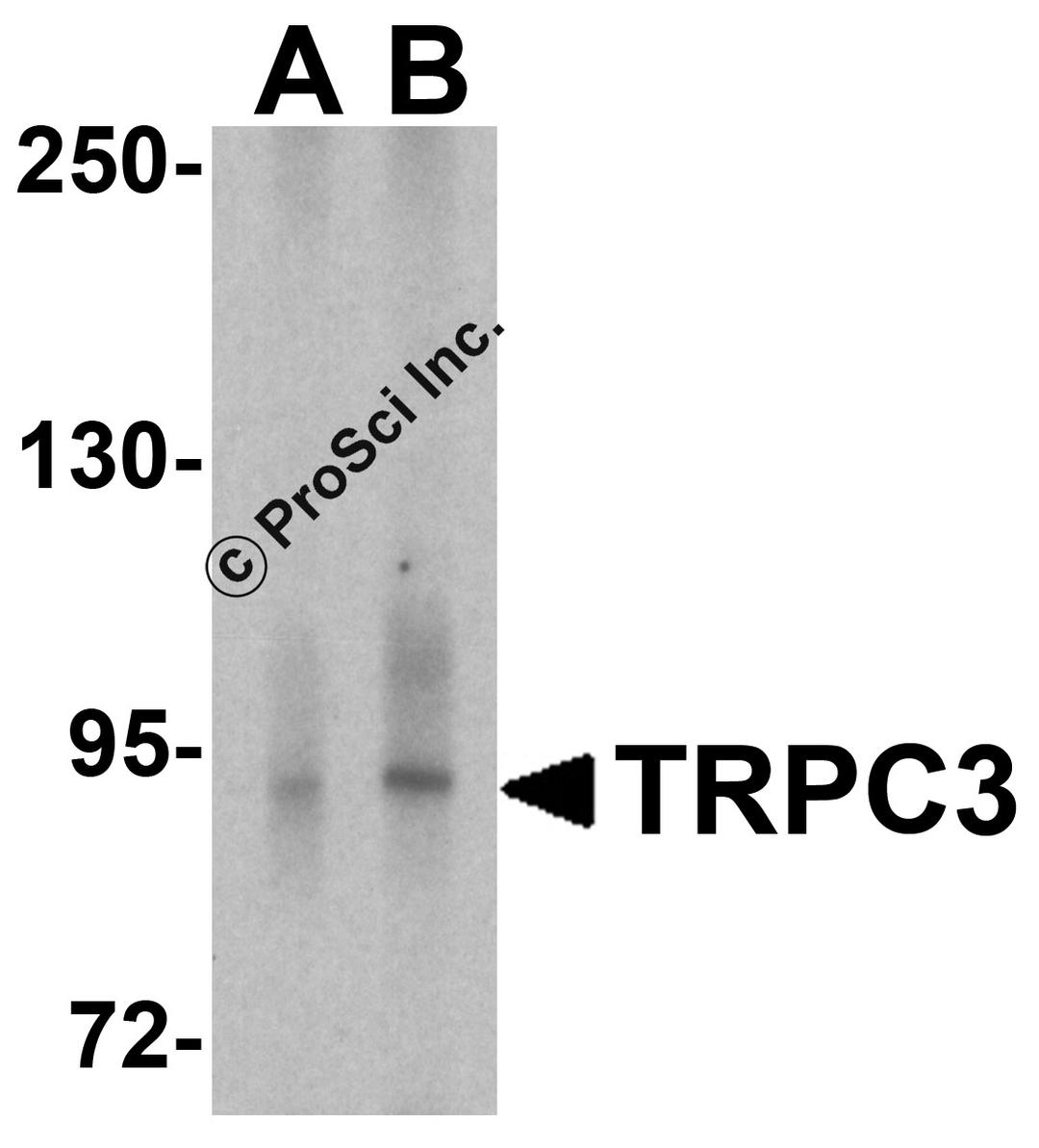 Western blot analysis of TRPC3 in human cerebellum tissue lysate with TRPC3 antibody at (A) 1 and (B) 2 μg/ml.
