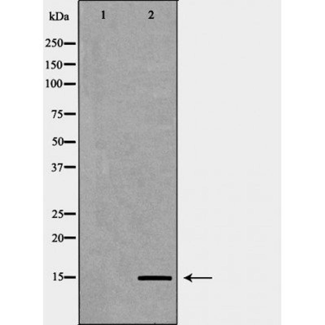 Western blot analysis of HeLa cell line and H3 protein expressed in E.coli using Histone H3K9me2 antibody