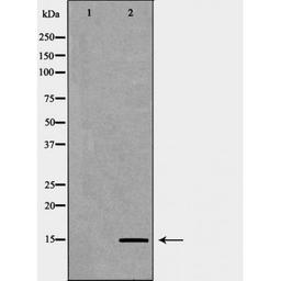 Western blot analysis of HeLa cell line and H3 protein expressed in E.coli using Histone H3K9me2 antibody