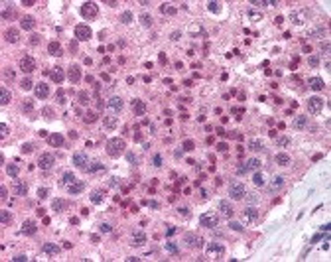 Immunohistochemistry staining of MAGEB1 in testis (formalin-fixed paraffin embedded) tissue using MAGEB1 Antibody.