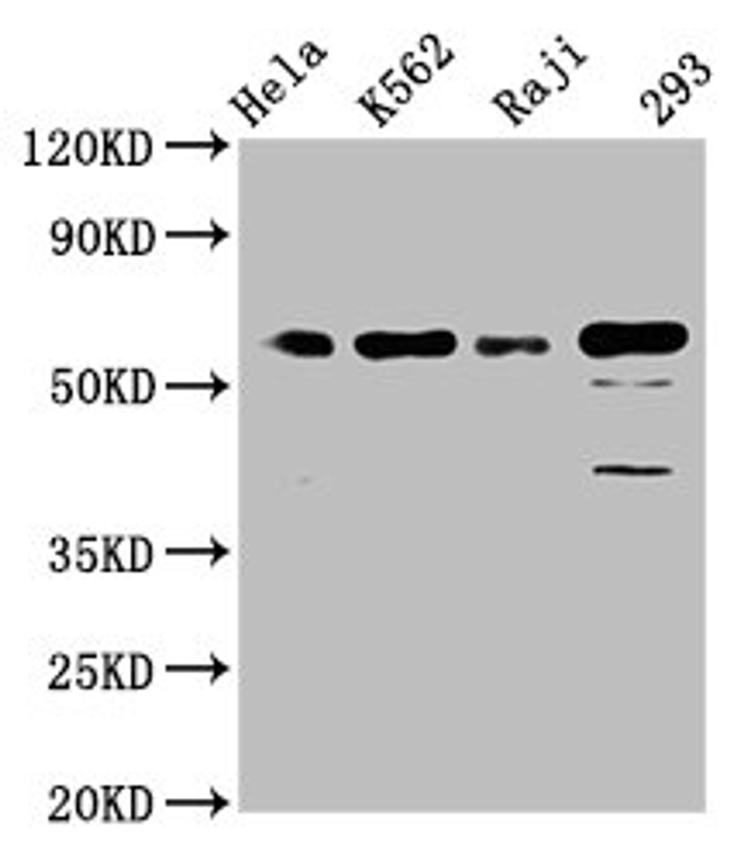 Western Blot. Positive WB detected in: Hela whole cell lysate, K562 whole cell lysate, Raji whole cell lysate, 293 whole cell lysate. All lanes: Cdc25C antibody at 1.65μg/ml. Secondary. Goat polyclonal to rabbit IgG at 1/50000 dilution. Predicted band size: 54, 52, 49, 46 KDa. Observed band size: 60 KDa. 