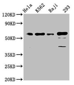 Western Blot. Positive WB detected in: Hela whole cell lysate, K562 whole cell lysate, Raji whole cell lysate, 293 whole cell lysate. All lanes: Cdc25C antibody at 1.65μg/ml. Secondary. Goat polyclonal to rabbit IgG at 1/50000 dilution. Predicted band size: 54, 52, 49, 46 KDa. Observed band size: 60 KDa. 