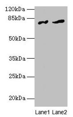Western blot. All lanes: FAM161A antibody at 8µg/ml. Lane 1: Human placenta tissue. Lane 2: Mouse liver tissue. Secondary. Goat polyclonal to rabbit IgG at 1/10000 dilution. Predicted band size: 77, 65, 84 kDa. Observed band size: 77 kDa