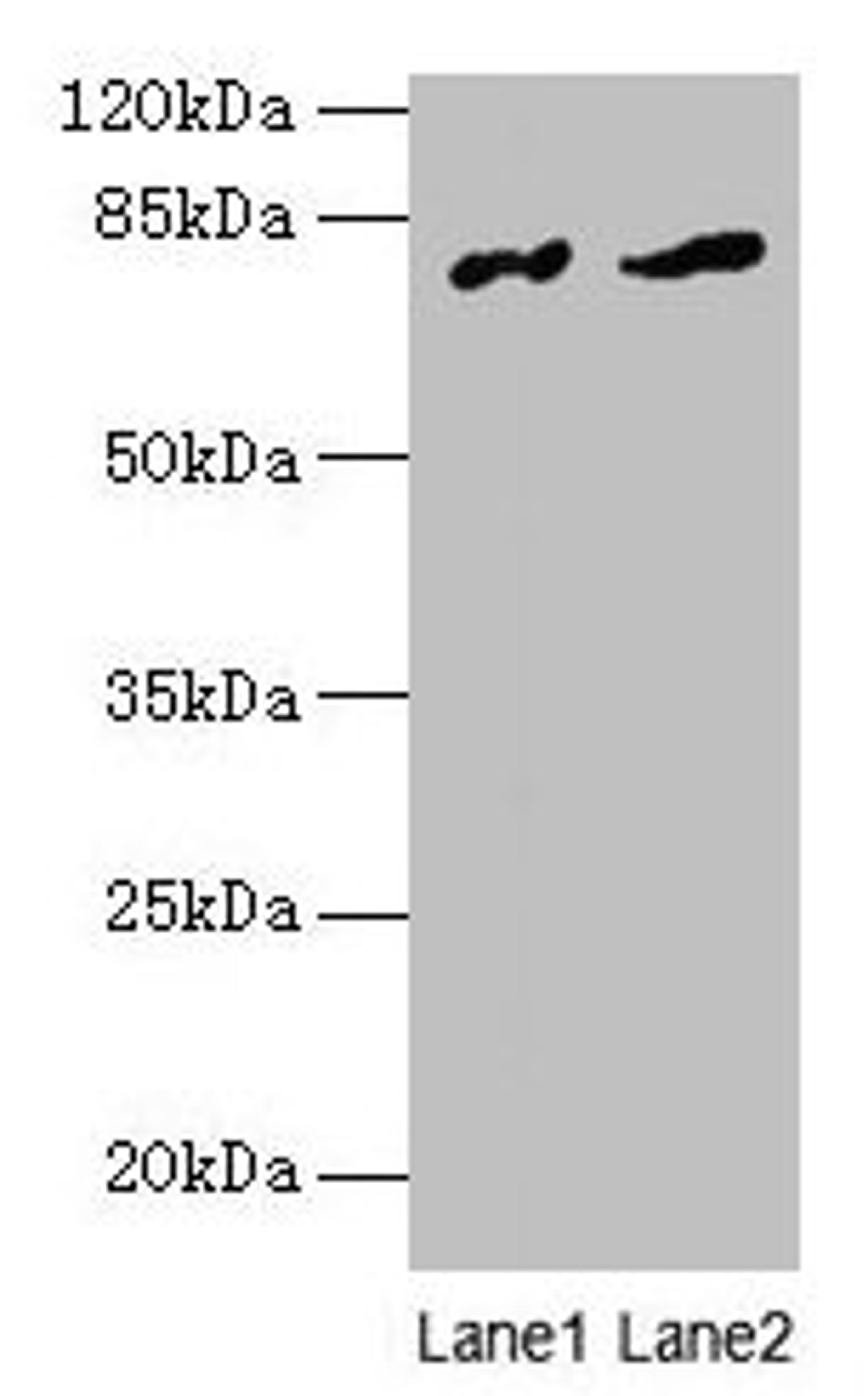 Western blot. All lanes: FAM161A antibody at 8µg/ml. Lane 1: Human placenta tissue. Lane 2: Mouse liver tissue. Secondary. Goat polyclonal to rabbit IgG at 1/10000 dilution. Predicted band size: 77, 65, 84 kDa. Observed band size: 77 kDa