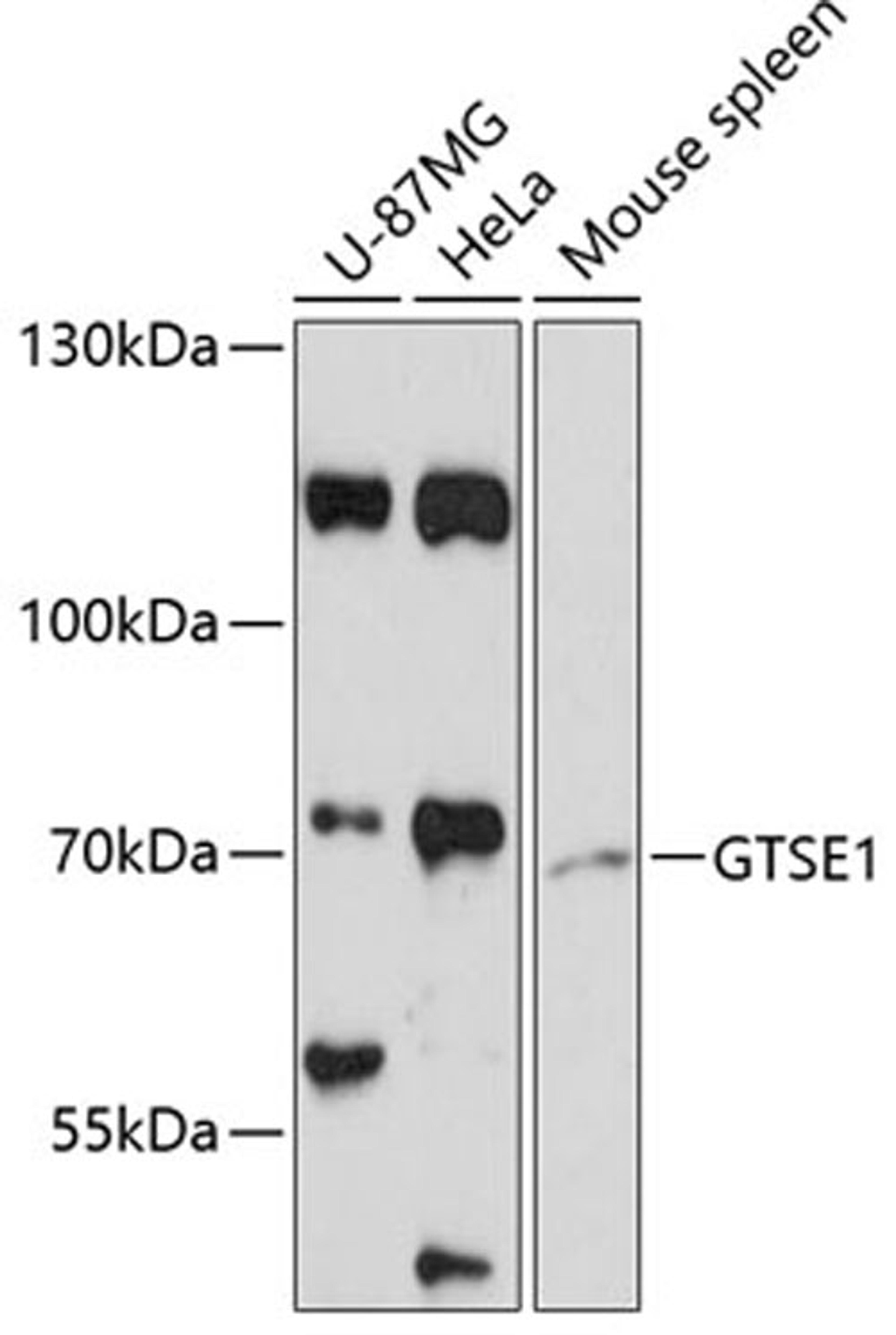 Western blot - GTSE1 antibody (A13903)