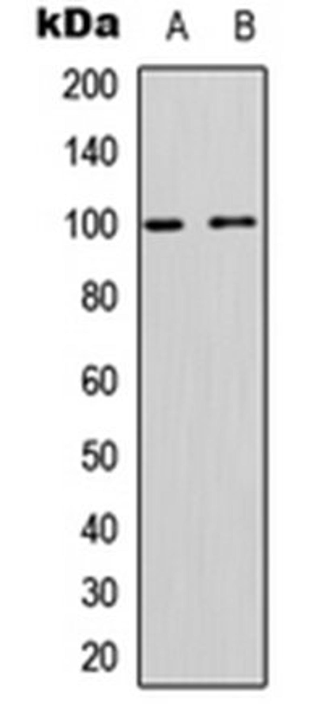 Western blot analysis of Jurkat (Lane 1), rat muscle (Lane 2) whole cell lysates using CD167a antibody