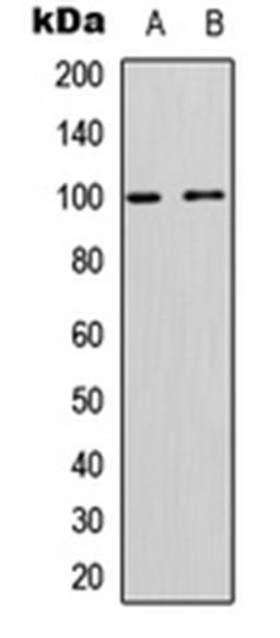 Western blot analysis of Jurkat (Lane 1), rat muscle (Lane 2) whole cell lysates using CD167a antibody