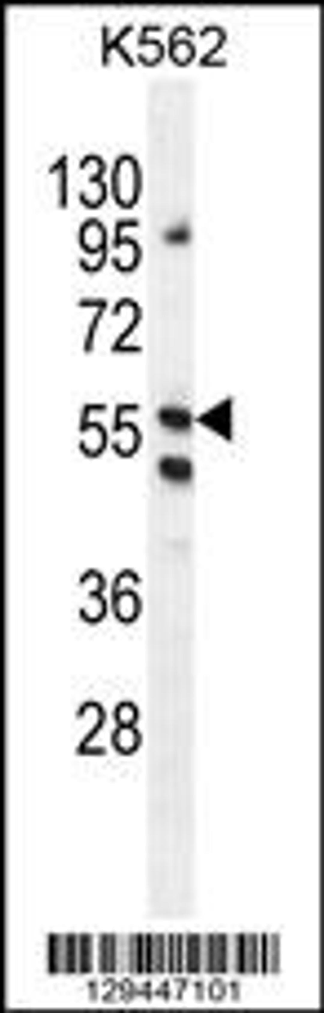 Western blot analysis in K562 cell line lysates (35ug/lane).