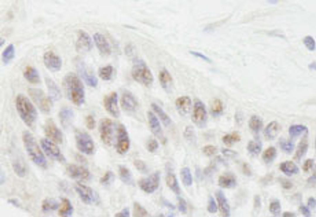 Detection of human RIF1 by immunohistochemistry.