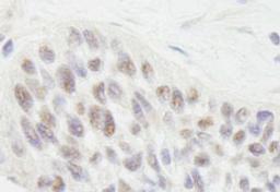 Detection of human RIF1 by immunohistochemistry.